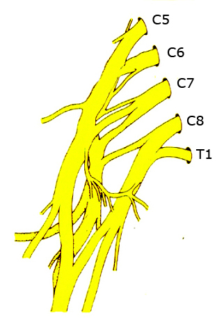 Schematisk bild av plexus brachialis - armens nervfläta. 